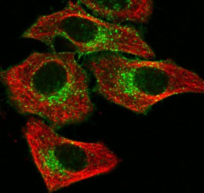 P-phycoerythrin.jpg