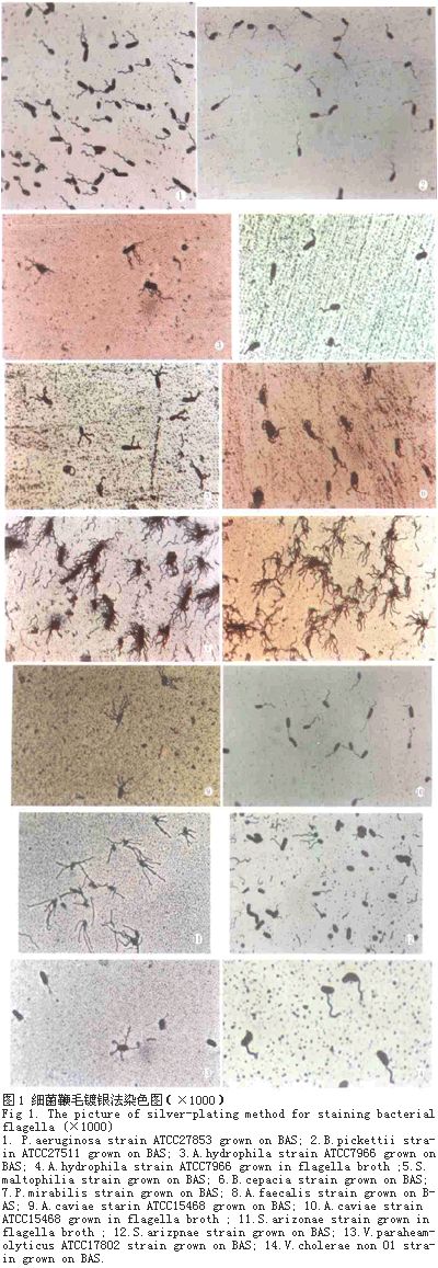 细菌鞭毛镀银染色法的创新