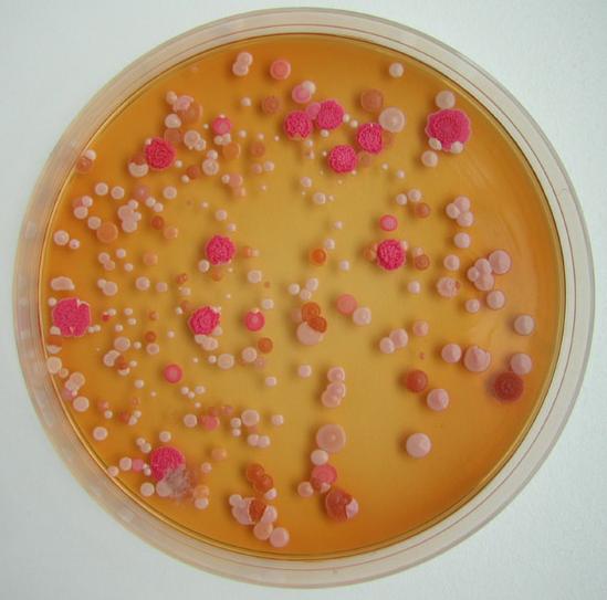 检验美学之菌落鉴赏_微生物检验_实验技术