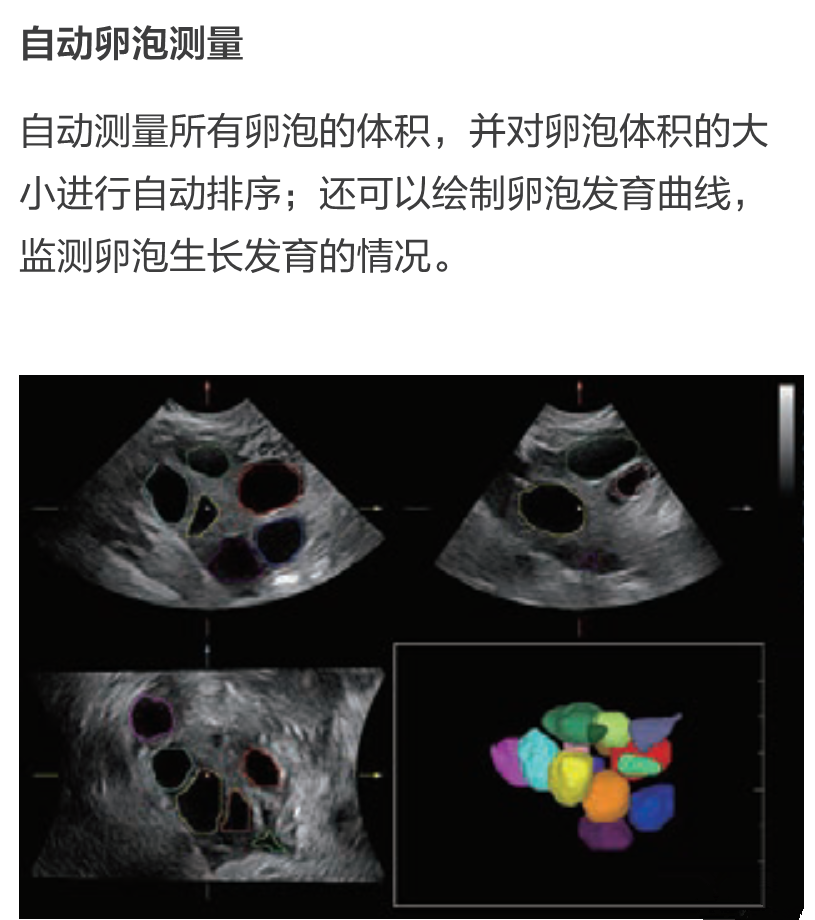 resona7怎么样国产昆仑高端系列超声迈瑞彩超Resona 6T_https://www.jmylbn.com_新闻资讯_第2张