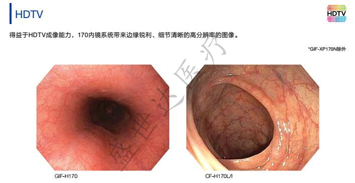olympus胃肠镜怎么调试全新进口奥林巴斯CV-170电子胃肠镜2021参数_https://www.jmylbn.com_新闻资讯_第2张