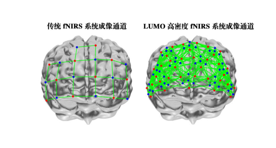 11. ErgoAI脑功能超扫描实验室1293.png