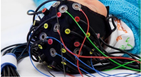 11. ErgoAI脑功能超扫描实验室1386.png