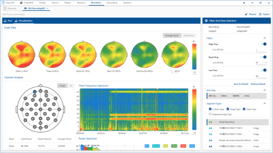 11. ErgoAI脑功能超扫描实验室1692.png