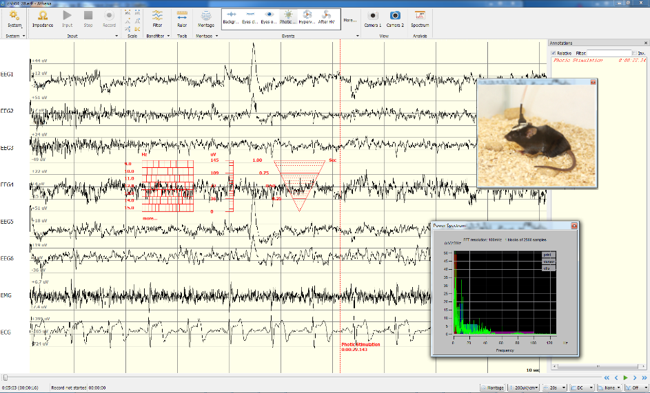 睡眠检测1.png 睡眠检测1.png
