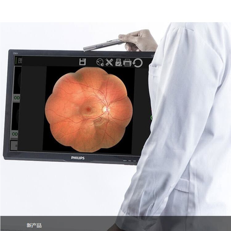 怎么躲过散瞳机新视野RetiCam 3100全自动免散瞳眼底照相机_https://www.jmylbn.com_新闻资讯_第3张