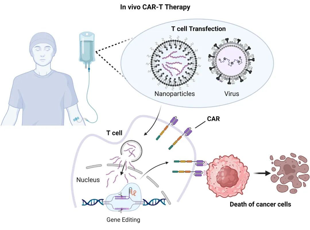 体内CAR-T技术流程示意图