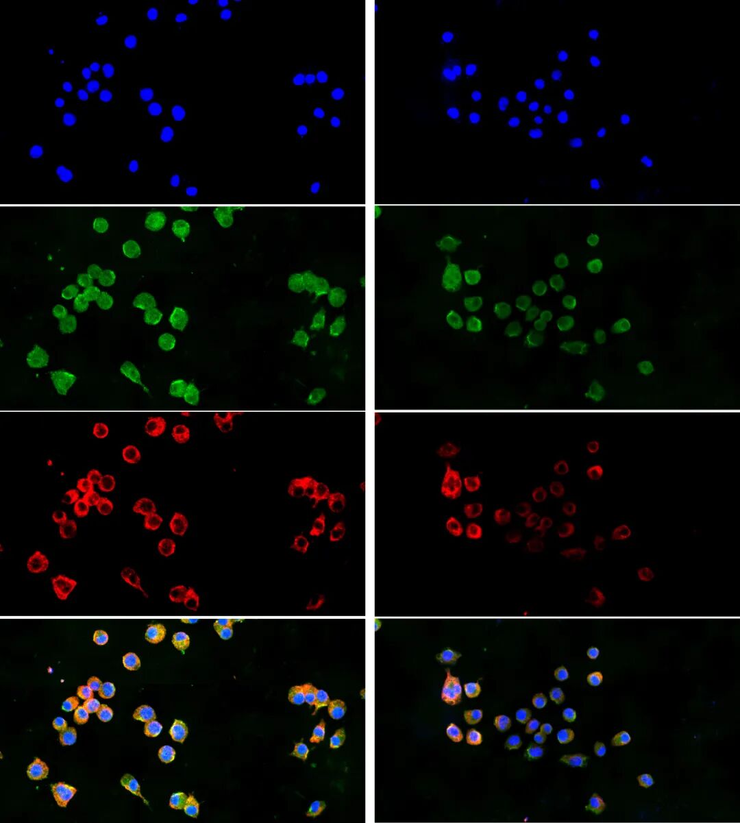图1. 免疫荧光检测结果